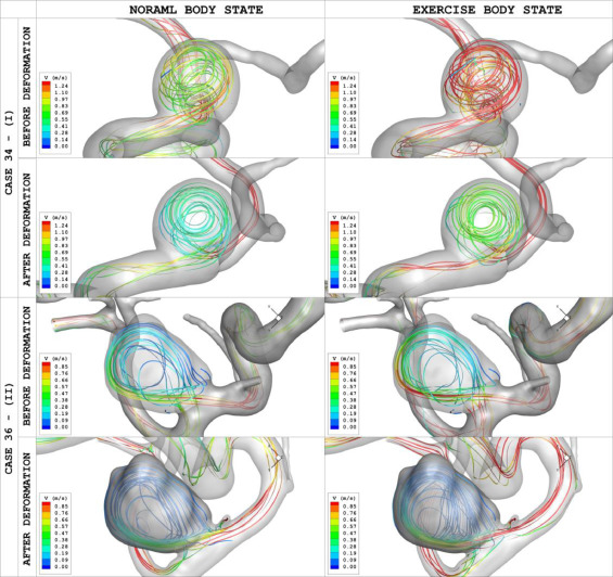 Hemodynamic responses to physical activity: Numerical analysis of ...