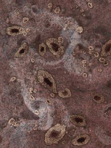 Cáncer en el Ecuador